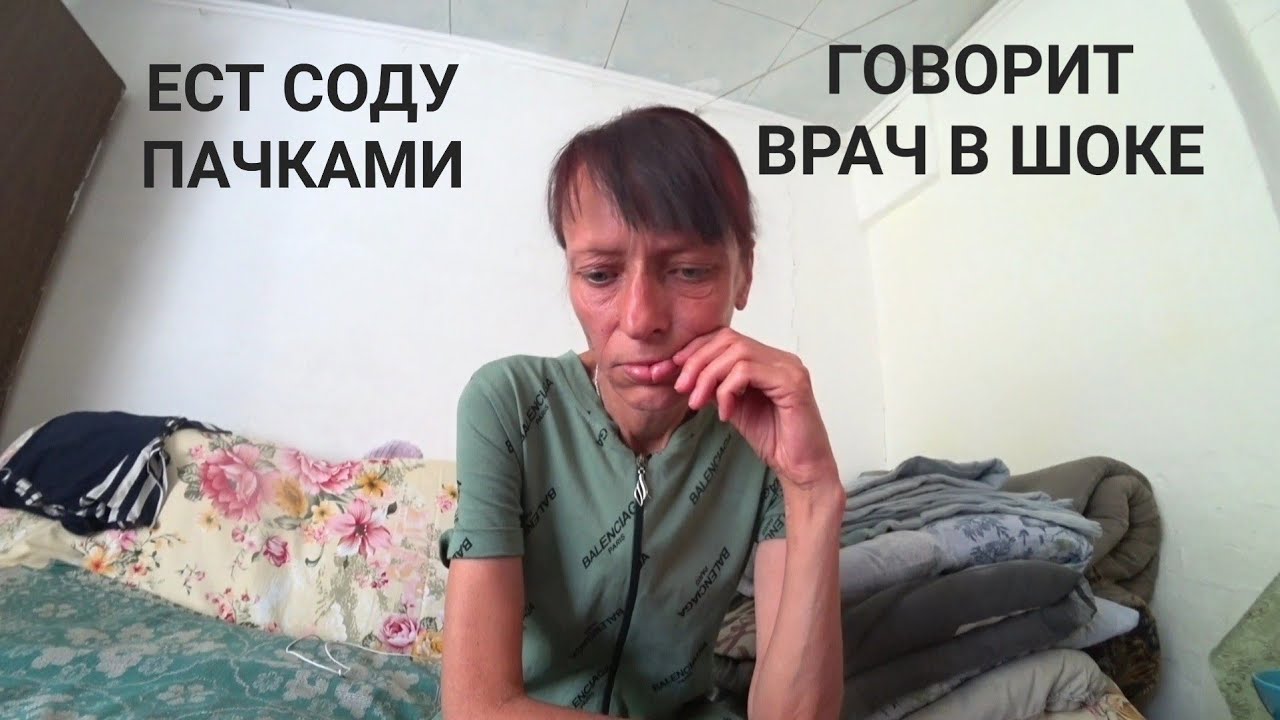 ЛЮДМИЛА СПАСАЕТСЯ СОДАЙ ОТ ИЗЖОГИ ПАЧКАМИ 😱 ТАБЛЕТКИ НЕ ПОМОГАЮТ ...