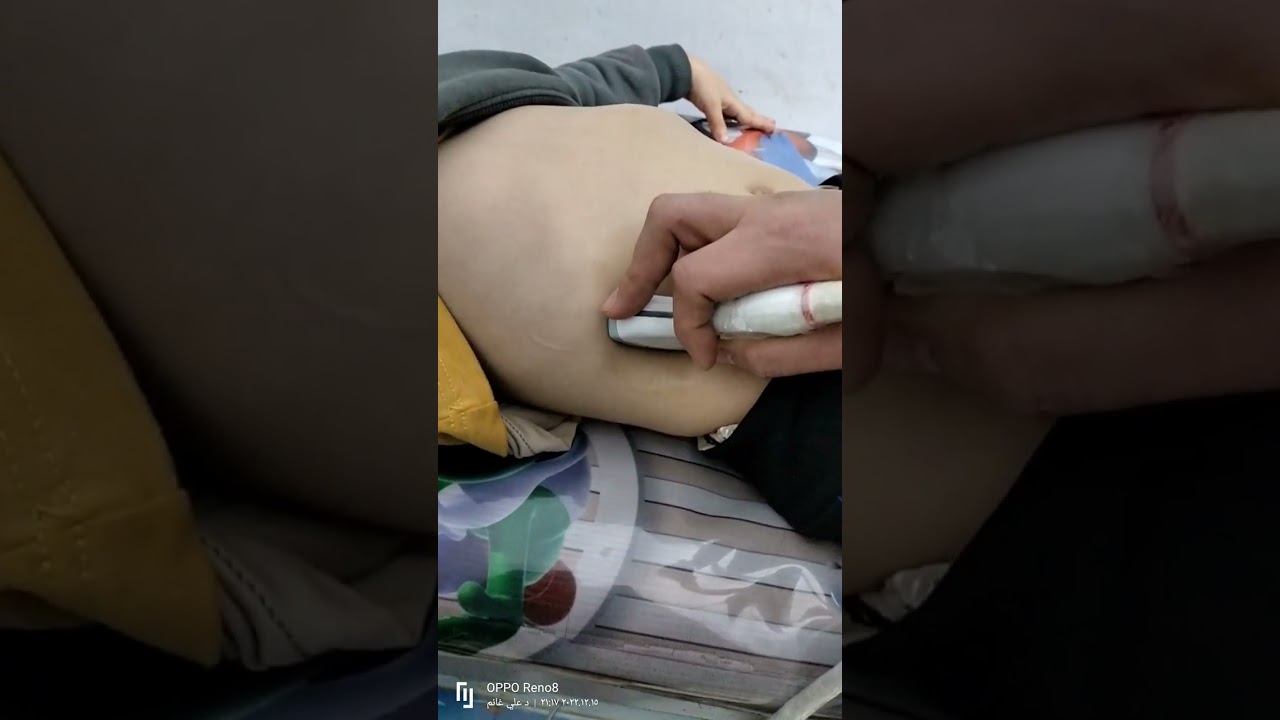 شرح السونار _احترف عمل سونار البطن والرئه كورس كامل بالشرح والتوضيح _ Abdominal ultrasound and lung