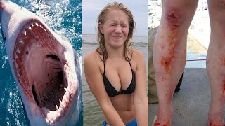 SHE GOT ATTACKED BY A SHARK!?!