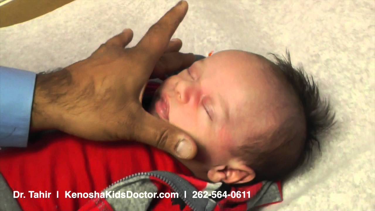 Blocked Tear Duct In Babies - YouTube Blocked Tear Duct In Babies - YouTube