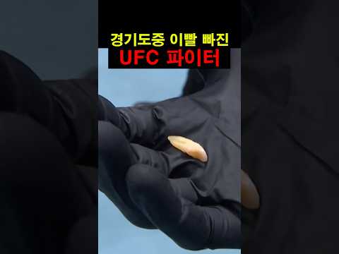 경기도중 이빨 빠진 UFC 파이터 thumbnail