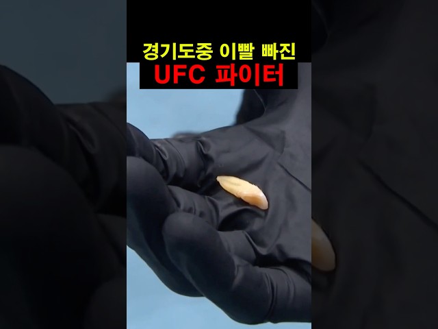 경기도중 이빨 빠진 UFC 파이터