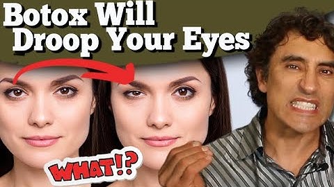 Why Botox Will Droop Your Eyes And How To Prevent This // Dr Rajani