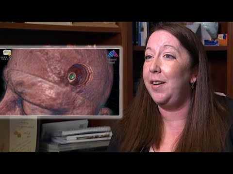 Video: The Reason For The Woman's Nightmares Turned Out To Be Brain Parasites - Alternative View