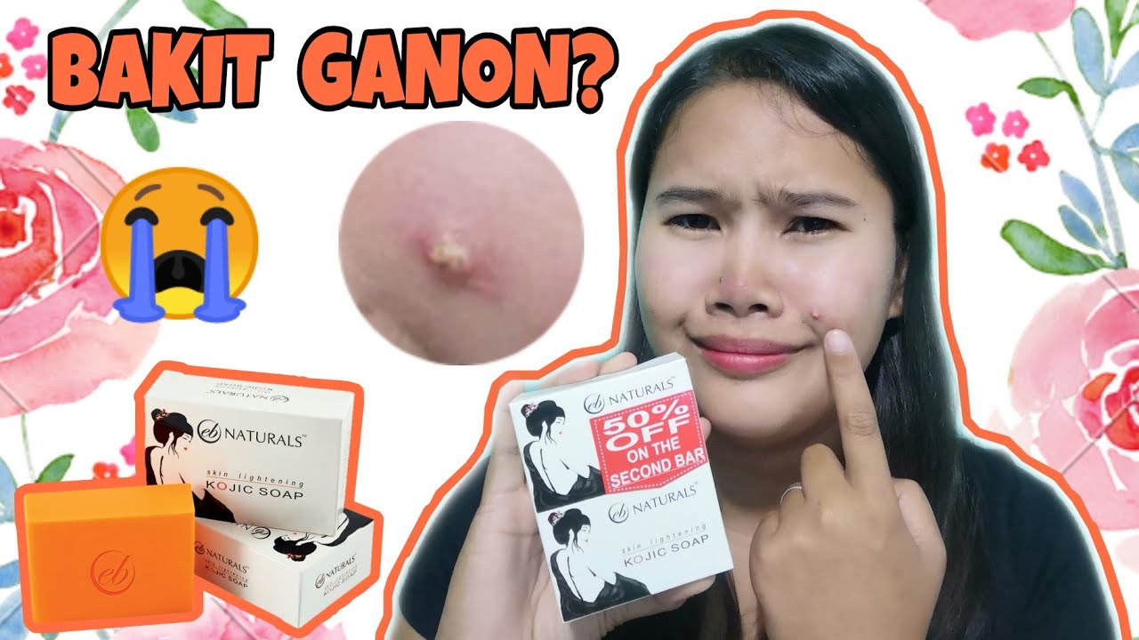 EVER BELINA NATURALS KOJIC SOAP BAKIT GANITO? | HONEST REVIEW AFTER 4 DAYS