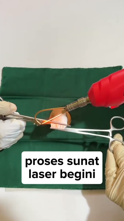 PROSES SUNAT LASER BEGINI #shorts