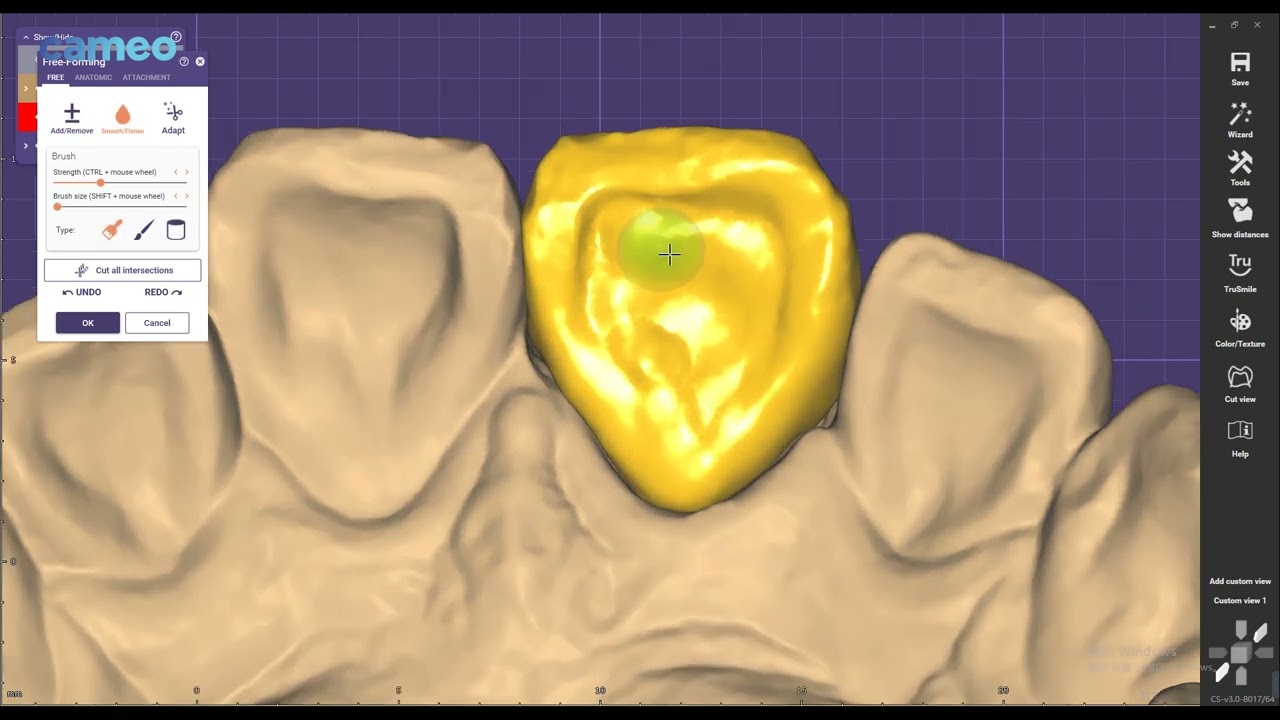 Aidite Exocad design guide: Anterior teeth design