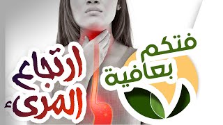 ارتجاع المرىء وازاي نقي نفسنا