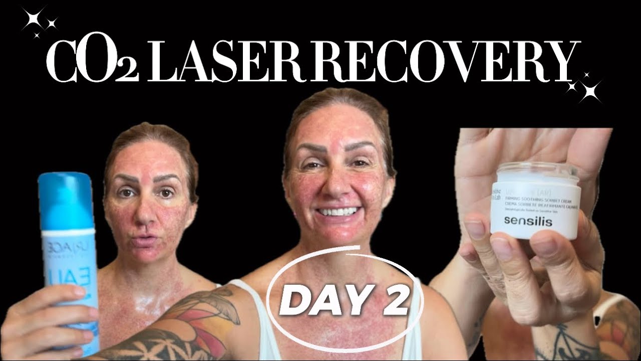 CO2 Ablative Laser Resurfacing Treatment In Mexico  - DAY 2 Recovery & After Care