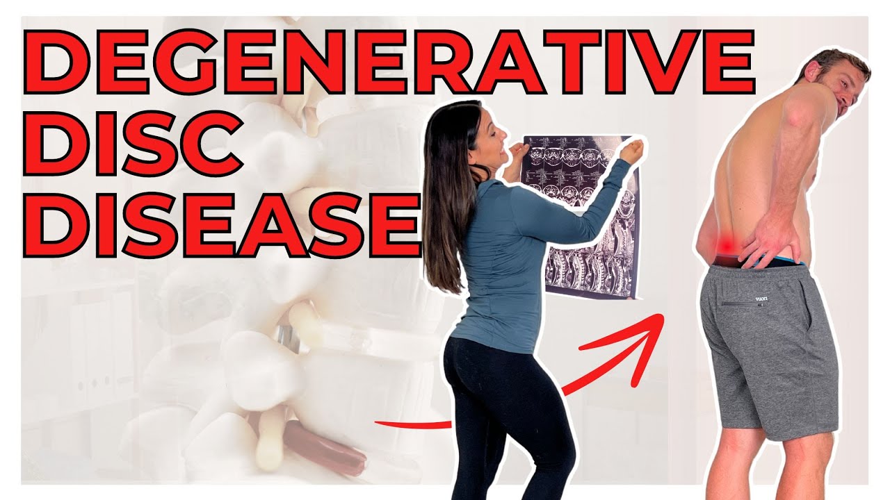 what is degenerative disc disease and what you can do - YouTube