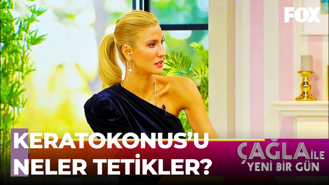 Keratokonus Hastalığı Nedir? - Çağla ile Yeni Bir Gün 477. Bölüm