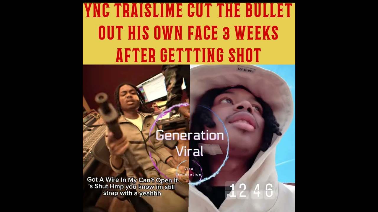 💥 YNC TRAISLIME CUT THE BULLET OUT HIS OWN FACE 3 WEEKS AFTER GETTING SHOT IN MEMPHIS 💥 
