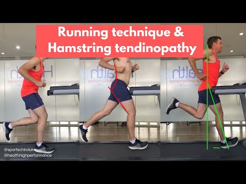Running technique & hamstring tendinopathy | Melbourne Sports Chiro & Physio