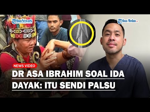 Video: Siapakah pakar bedah mata?