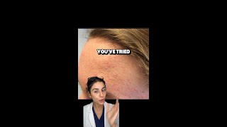 Struggling with small bumps on your forehead?