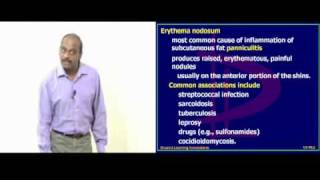 Pathology Sample Lec_4.avi