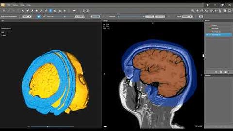Brain MRI segmentation to mesh file, done in under 20 minutes!