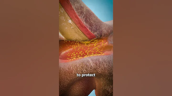 How To Properly Remove Ear Wax 😲