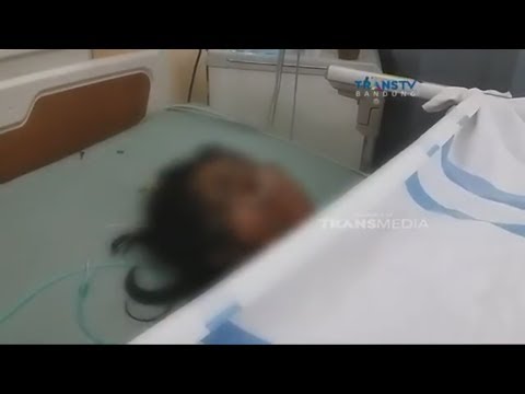 Video: Melepuh Pada Kaki: Penyebab Dan Perawatan