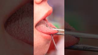 The Problem with Tongue Piercings 👅 Risks & Tips! #shorts #oralpiercing
