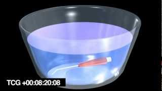 Air Polisher Overview.52412.mp4