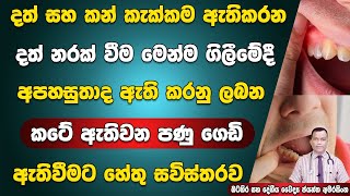 දත සහ කන කකකම ඇතකරන දත නරකවම මනම ගලම අපහසත ඇතකරන කට ඇතවන පණ ගඩ Tooth Abscesses