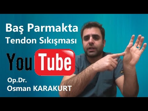 ⭐️Başparmak Tendon Sıkışması Nasıl Tedavi Edilir? ✅De Quervain Tenosinoviti