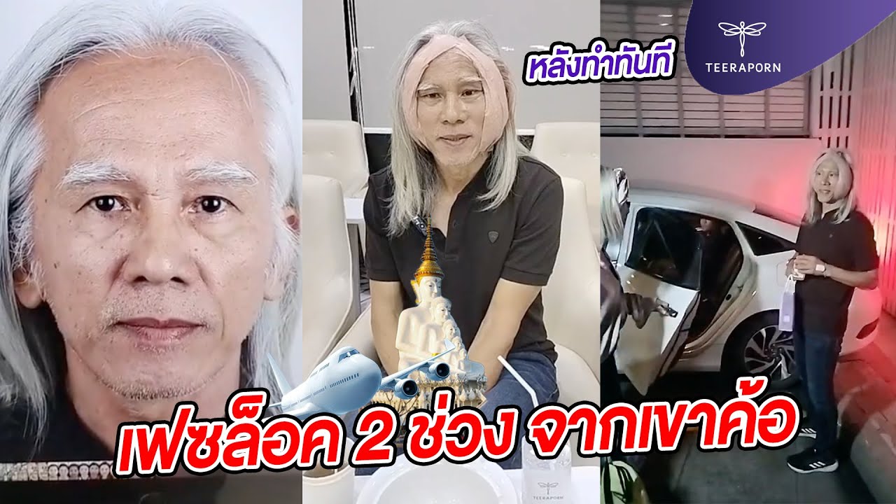 อายุ 62 คุณพ่อ ดึงหน้า FACE- LOCK ส่งตรงจากเขาค้อ ธีรพรคลินิก หมอชลธิศ