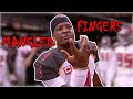 More Mangled Fingers in the NFL