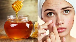 فوائد العسل المذهلة للجسم إذا أكلت العسل صباحا على معدة فارغة فسوف تحصل على هذه الفوائد النادرة