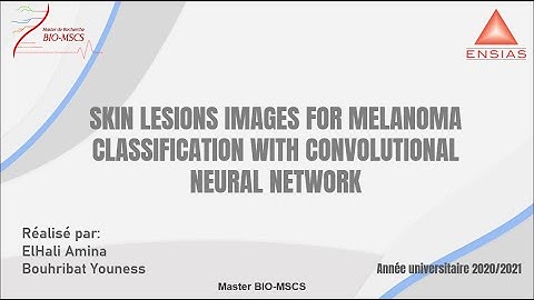 Skin Lesions Classification with Deep Convolutional Neural Network