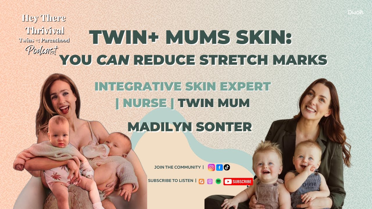 How to Avoid Pregnancy Stretch Marks for Twin Parents, Pregnancy-Safe Skin Care, Birth Skin Effects