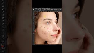 How to remove pimples on face in Photoshop