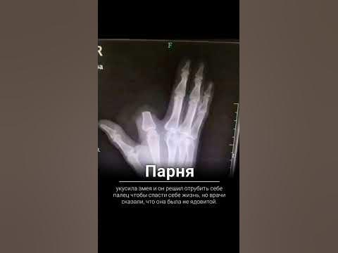 ОТРЕЗАЛ ПАЛЕЦ - YouTube