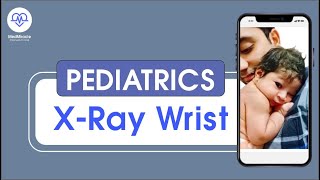 X-ray Wrist by Dr. Anand Bhatia @medmiracle952