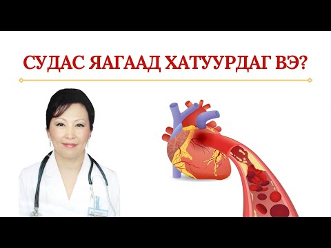 Видео: Яагаад атеросклероз нь зүрхний шигдээс үүсгэдэг вэ?
