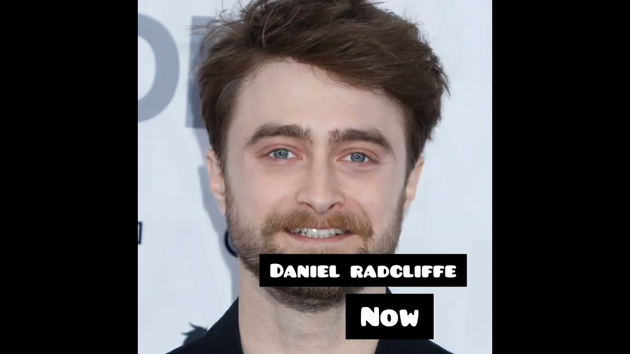 { Harry potter cast } Then Vs Now