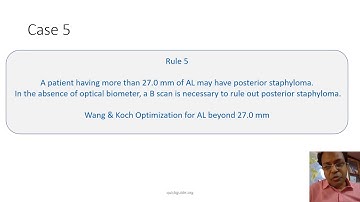 Biometry Case Study (continued)-Session 2  (for free biometry validation tool,visit quickguide.org))