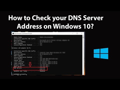 Where do I find DNS 1?