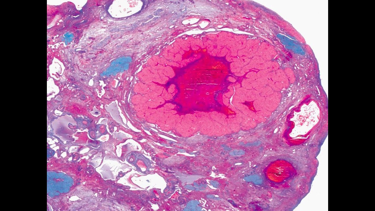 История открытия прогестерона @DrOlenaB
