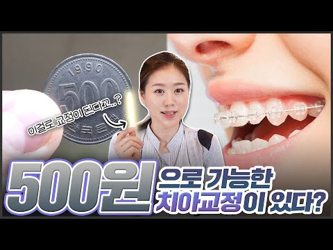단돈 500원으로 치아교정 가능합니다 | 실제 치의학 교과서에 나온 치료 방법 공개!