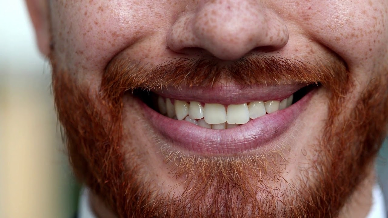 WIN An Ultimate Smile Makeover