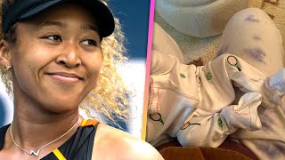 Naomi Osaka shares a first look at her newborn daughter since giving birth in a new post on Insta…