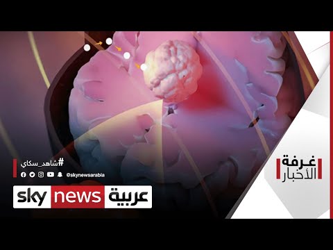 عالم الطب علاج ثوري للسرطان غرفة الأخبار