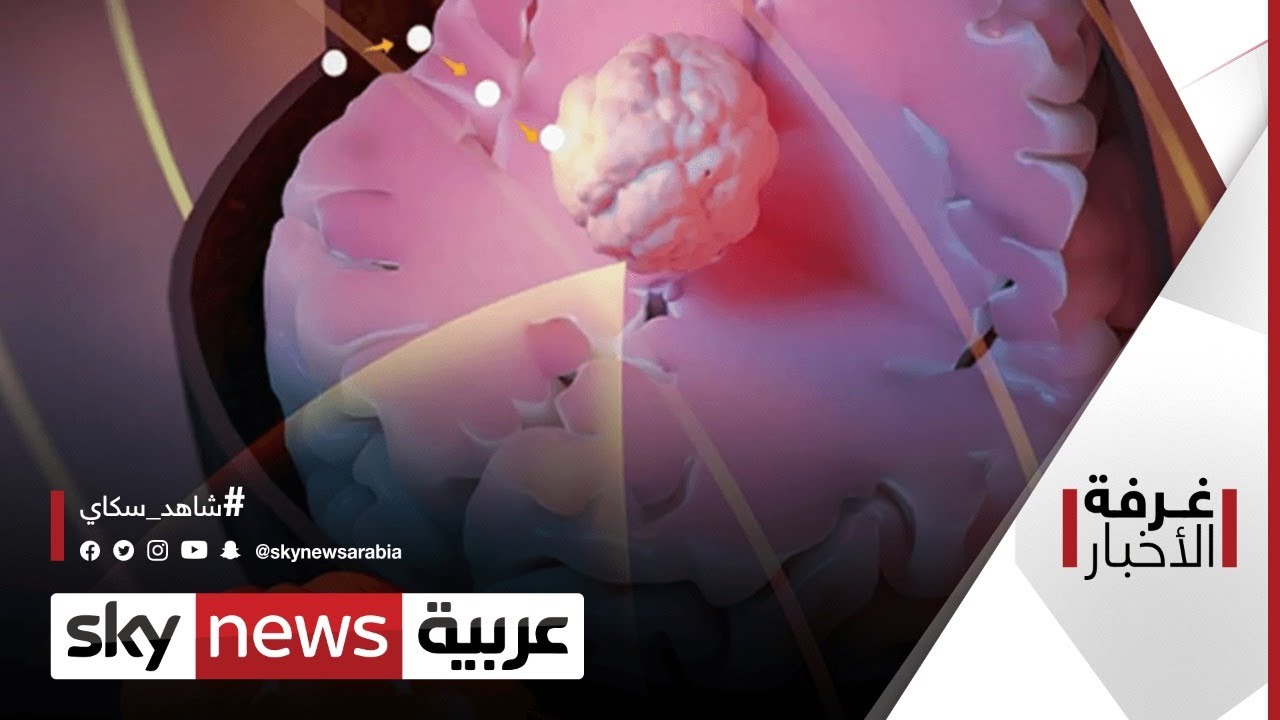 عالم الطب.. علاج ثوري للسرطان | #غرفة_الأخبار