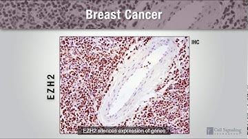 VIDÉO - Cell Signaling Technogy "Epigenetic Drivers of Breast Cancer"
