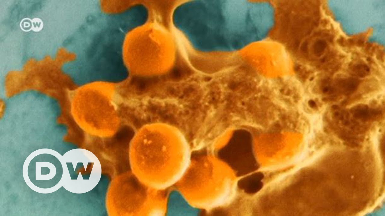 Süper bakterilere karşı silah yolda - DW Türkçe