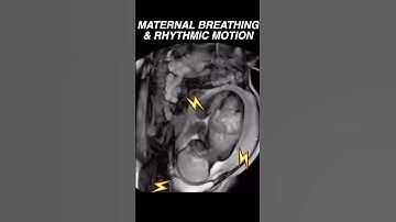 Maternal breathing provides rhythmic motion for baby visualized via MRI #radiology #pregnancy #mom