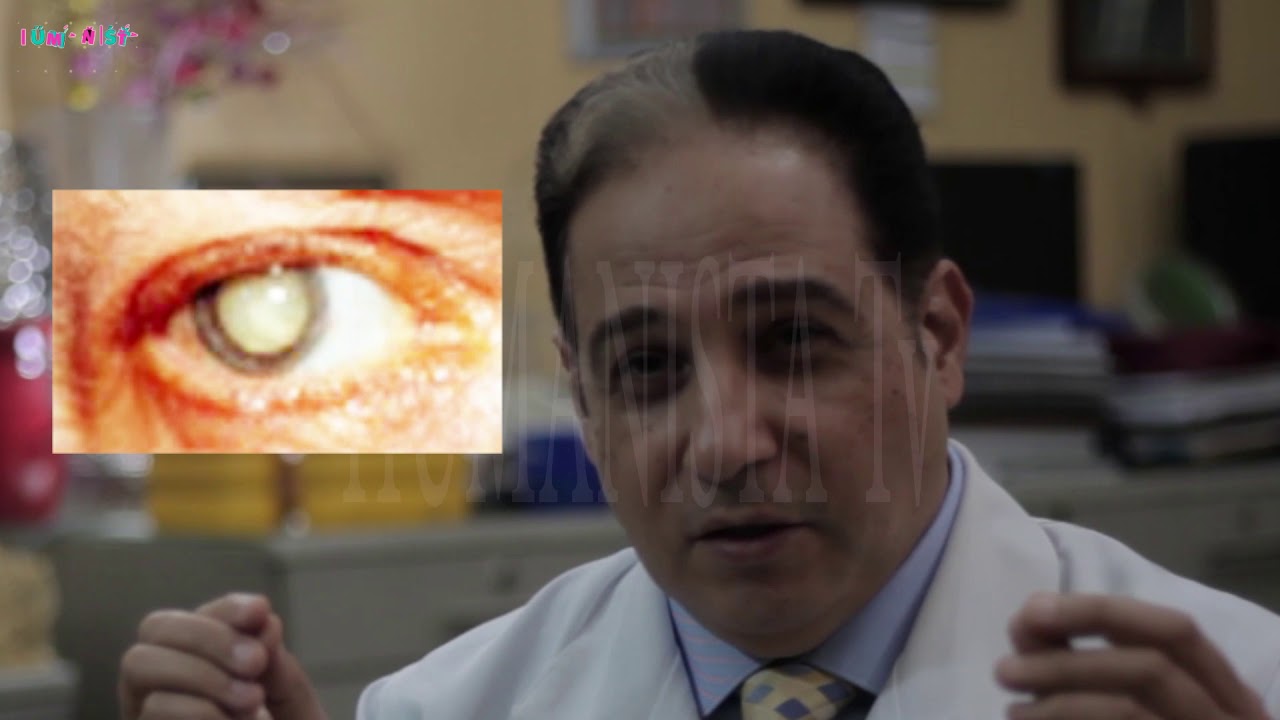 هل إزالة المياه البيضاء يقوى الإبصار؟و متى تعاد العمليه؟ ا.د/أشرف الهباق أستاذ العيون#نسمه_إبراهيم