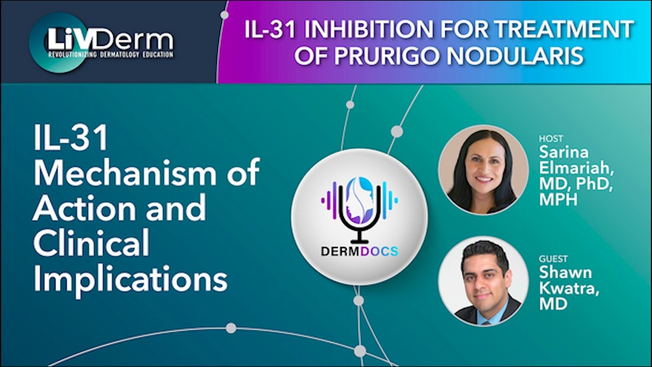 IL 31 Mechanism of Action and Clinical Implications for Prurigo Nodularis